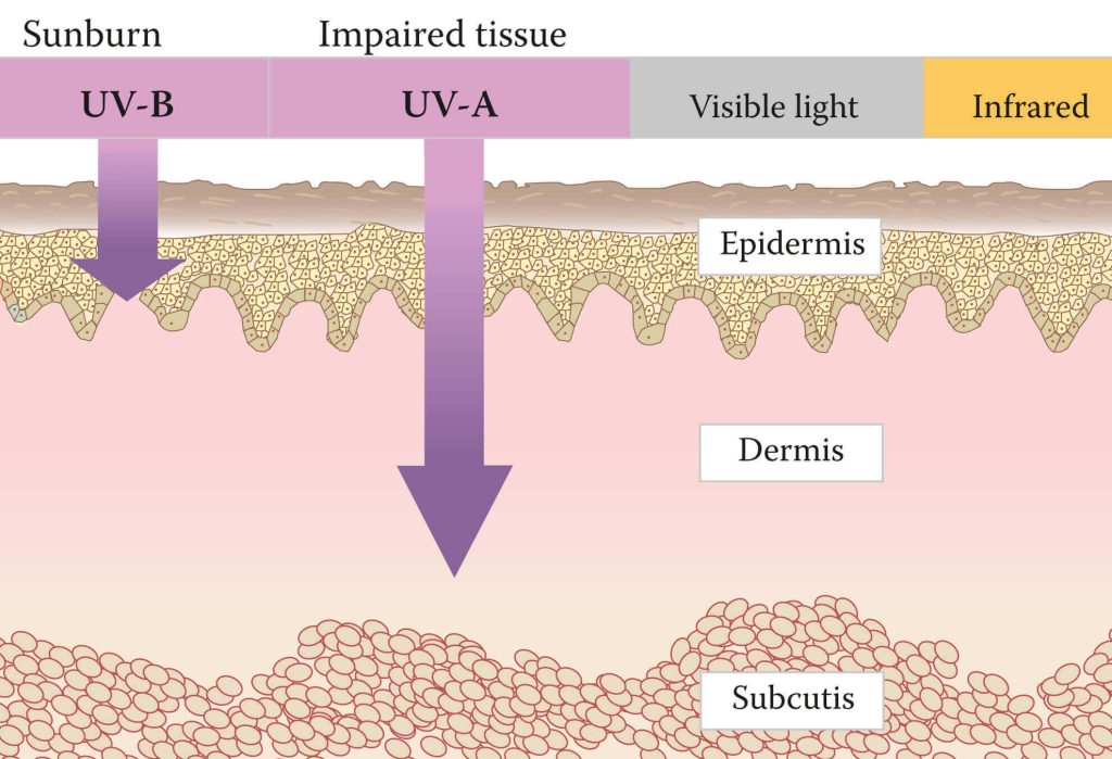 Side Effects of UVB Treatment