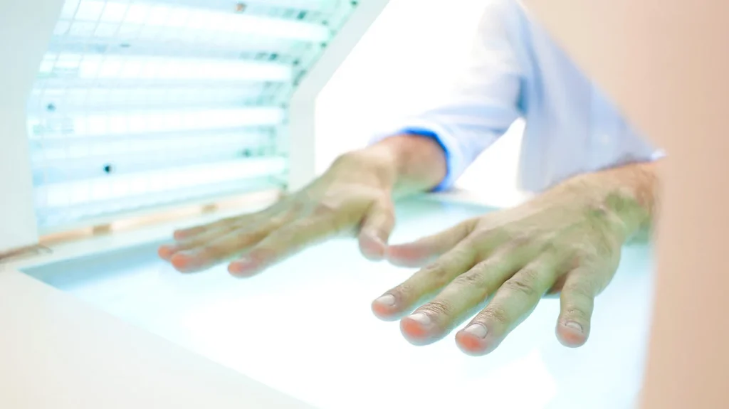 Light Therapy for Psoriasis: What You Need to Know