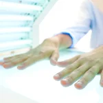 Light Therapy for Psoriasis: What You Need to Know